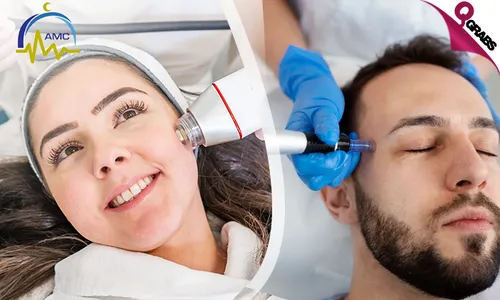 Radio Frequency Microneedling Skin Treatment for Ladies & Men!